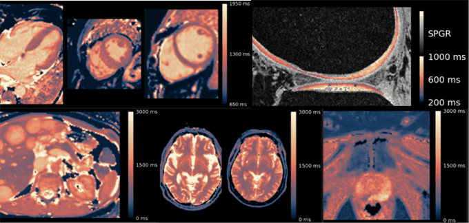 Colormap recommendations for quantitative MRI